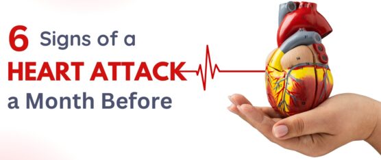 Signs of a Heart Attack