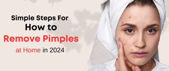 How to remove pimples