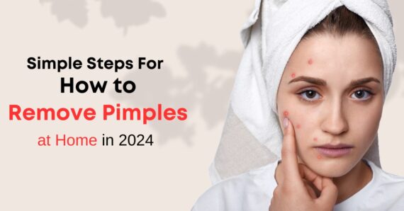 Simple Steps For How to Remove Pimples at Home in 2024