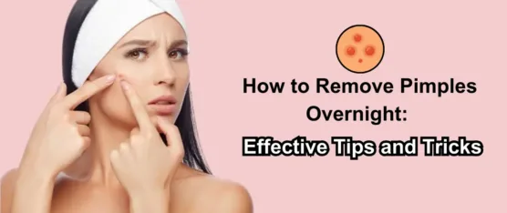 how to remove pimples overnight