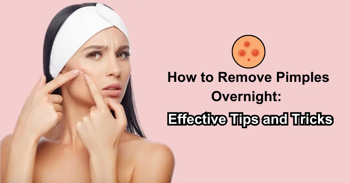  How to Remove Pimples Overnight: Effective Tips and Tricks