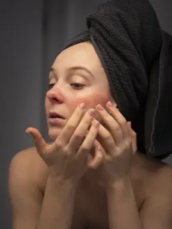 How to Remove Pimples Overnight: Effective Tips and Tricks