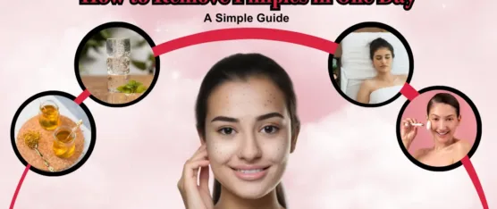 how to remove pimples in one day