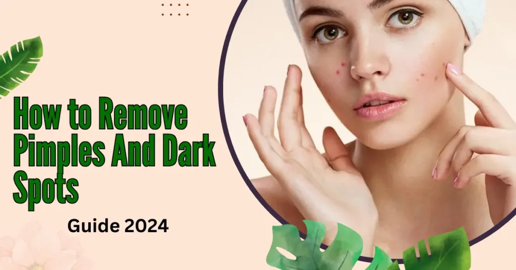 How to Remove Pimples And Dark Spots- Guide 2024