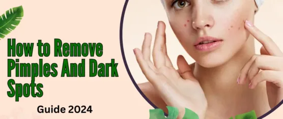 how to remove pimples and dark spots