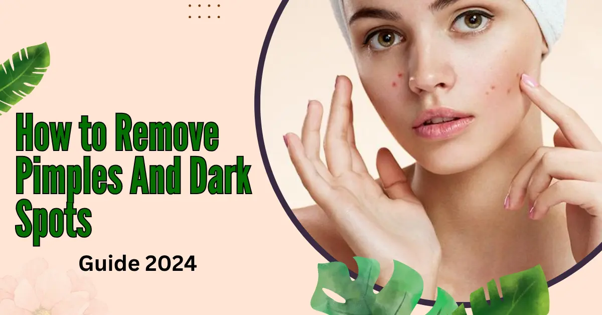  How to Remove Pimples And Dark Spots- Guide 2024