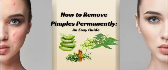 how to remove pimples permanently