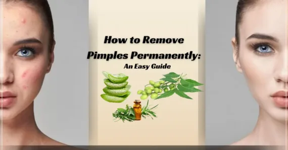 How to Remove Pimples Permanently: An Easy Guide