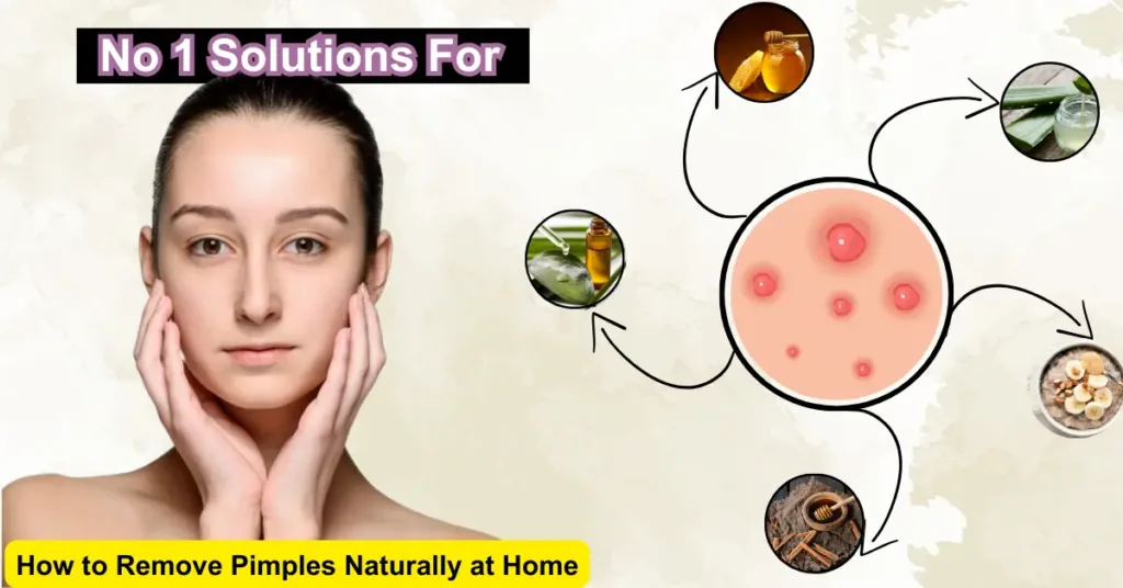 No 1 Solutions For How to Remove Pimples Naturally at Home